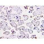 Validation Data - Anti-hCGß Antibody [YN00936m] (A288748)