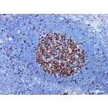 Validation Data - Anti-Ki-67 Antibody [YN00995m] (A288749)