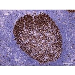 Validation Data - Anti-Ki-67 Antibody [YN00995r] (A288750)