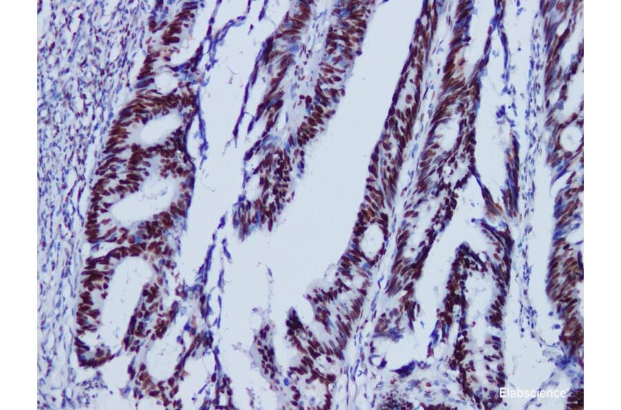 Validation Data - Anti-MutS Protein Homolog 6(MSH6) Antibody [YN01135m] (A288751)