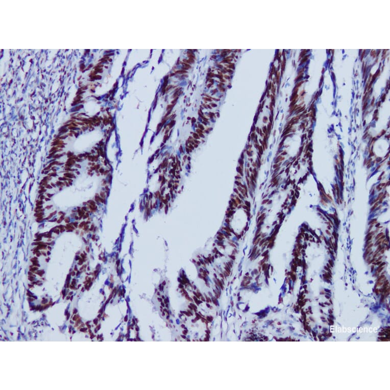 Validation Data - Anti-MutS Protein Homolog 6(MSH6) Antibody [YN01135m] (A288751)