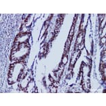 Validation Data - Anti-MutS Protein Homolog 6(MSH6) Antibody [YN01135m] (A288751)