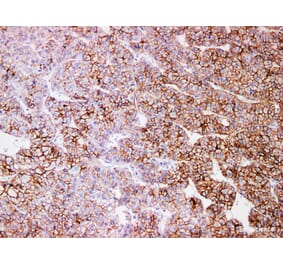 Validation Data - Anti-N-Cadherin Antibody [YN01186m] (A288753)