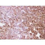 Validation Data - Anti-N-Cadherin Antibody [YN01186m] (A288753)