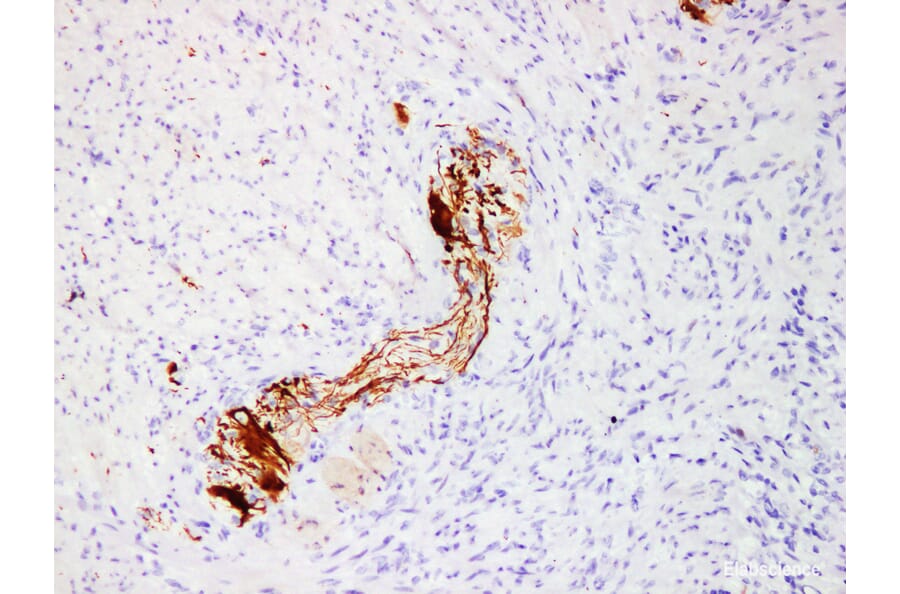 Validation Data - Anti-Neurofilament(NF) Antibody [YN01196m] (A288754)