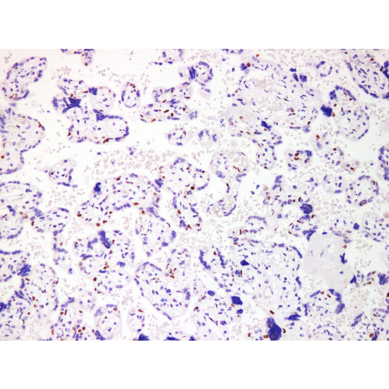 Validation Data - Anti-p57 Antibody [YN01246m] (A288755)