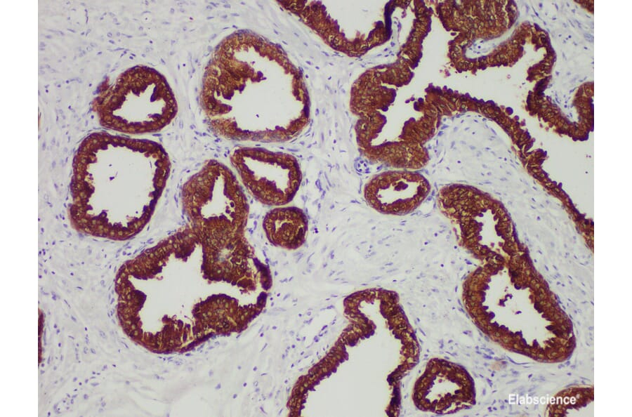 Validation Data - Anti-Prostate-Specific Antigen(PSA) Antibody [YN01395m] (A288757)