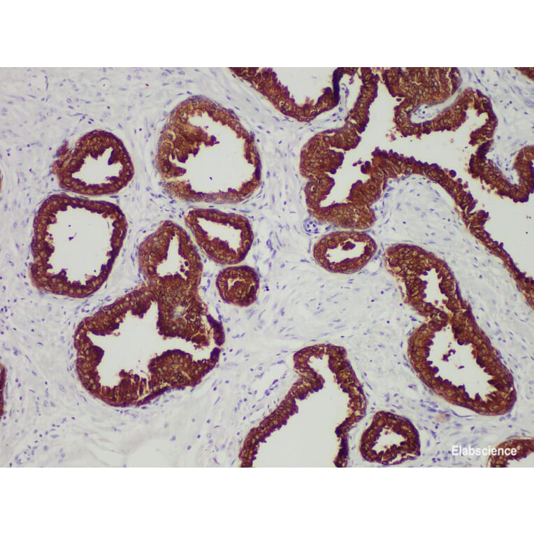 Validation Data - Anti-Prostate-Specific Antigen(PSA) Antibody [YN01395m] (A288757)