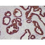 Validation Data - Anti-Prostate-Specific Antigen(PSA) Antibody [YN01395m] (A288757)
