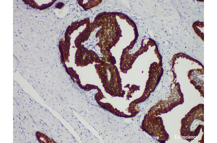 Validation Data - Anti-Prostate-Specific Antigen(PSA) Antibody [YN01395r] (A288758)