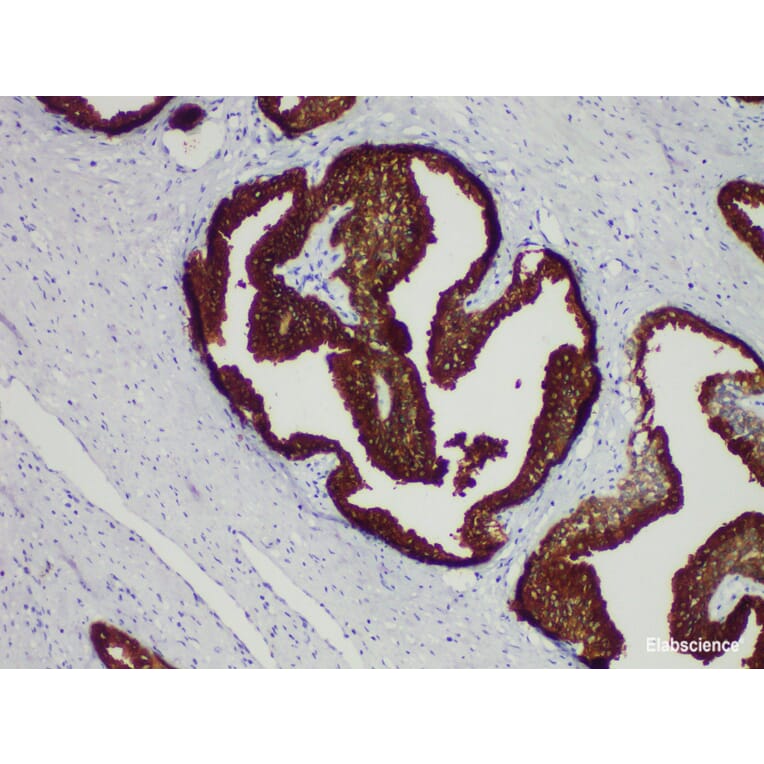 Validation Data - Anti-Prostate-Specific Antigen(PSA) Antibody [YN01395r] (A288758)