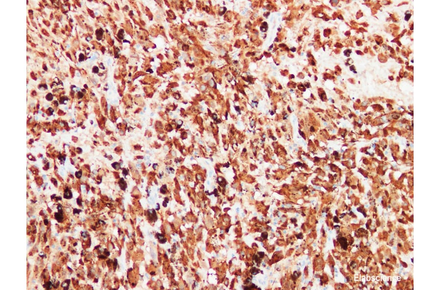 Validation Data - Anti-S100 Antibody [YN01456m] (A288759)