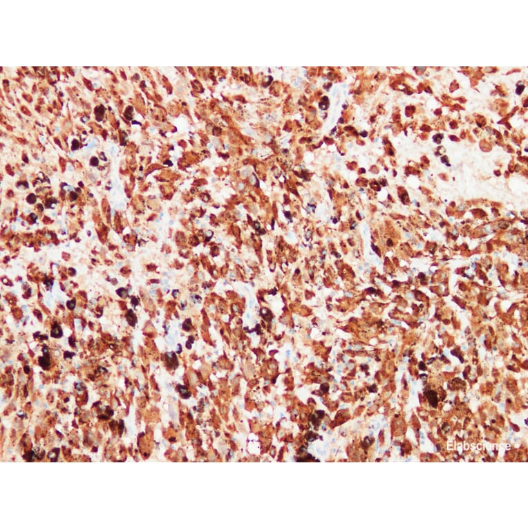 Validation Data - Anti-S100 Antibody [YN01456m] (A288759)