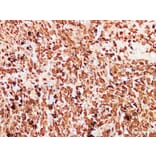 Validation Data - Anti-S100 Antibody [YN01456m] (A288759)