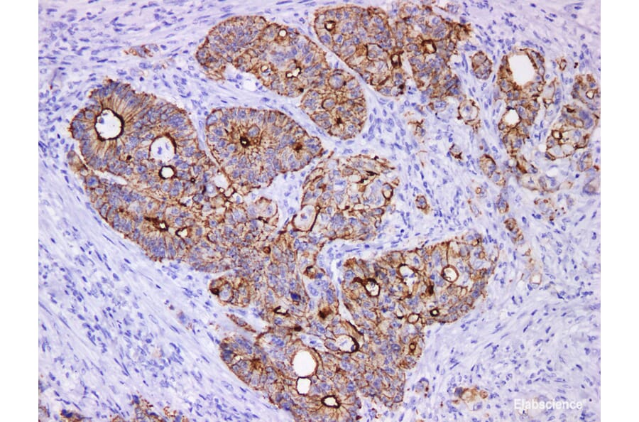 Validation Data - Anti-Villin Antibody [YN01675m] (A288761)