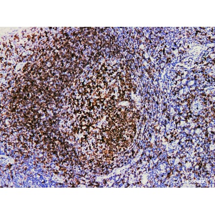 Validation Data - Anti-CD74 Antibody [YN00426m] (A288769)