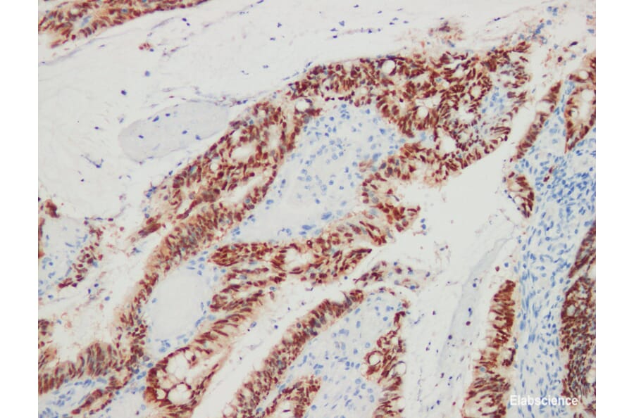 Validation Data - Anti-CDX-2 Antibody [YN00475m] (A288770)