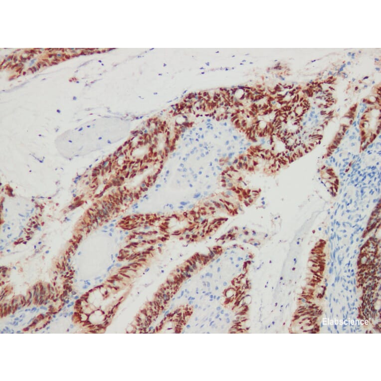 Validation Data - Anti-CDX-2 Antibody [YN00475m] (A288770)