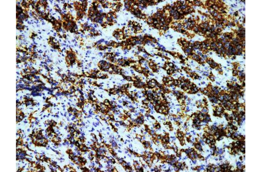 Validation Data - Anti-Prolactin(PRL) Antibody [YN01376m ] (A288774)