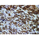 Validation Data - Anti-Prolactin(PRL) Antibody [YN01376m ] (A288774)