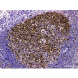 Validation Data - Anti-Topoisomerase IIa Antibody [YN01635m] (A288776)