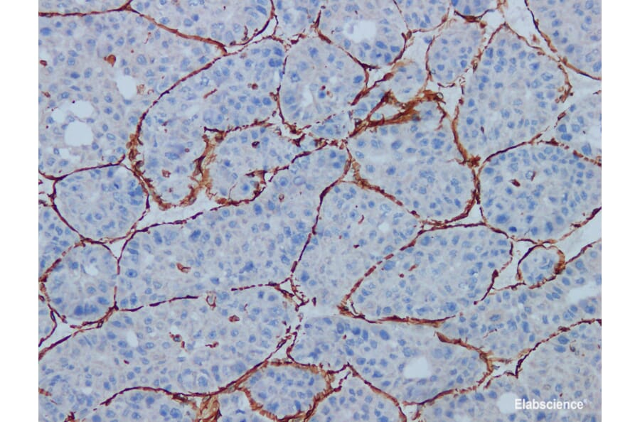 Validation Data - Anti-Vimentin Antibody [YN01685m] (A288777)