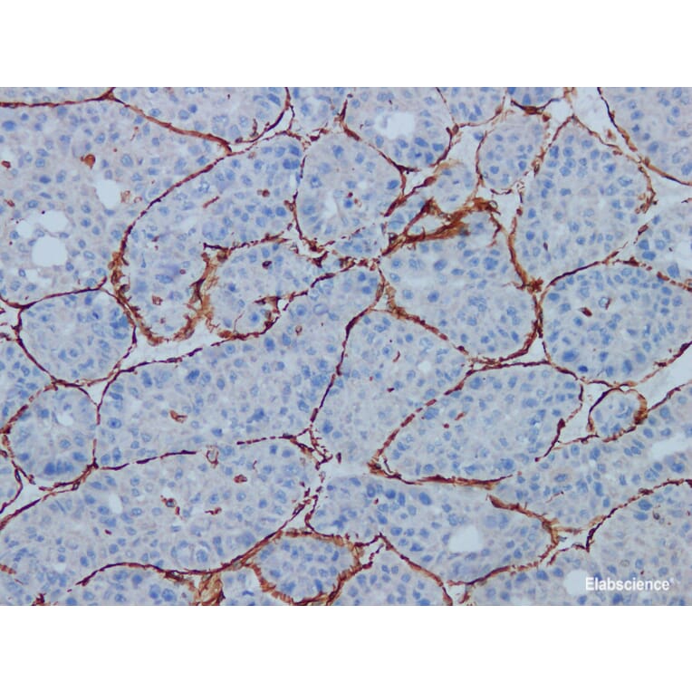 Validation Data - Anti-Vimentin Antibody [YN01685m] (A288777)