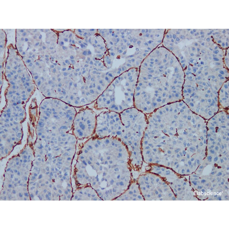 Validation Data - Anti-Vimentin Antibody [YN01685r] (A288778)