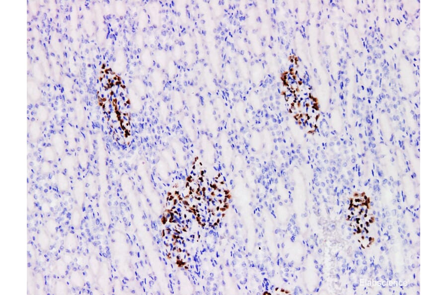 Validation Data - Anti-Wilms' Tumor 1(WT1) Antibody [YN01705m] (A288779)