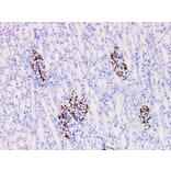Validation Data - Anti-Wilms' Tumor 1(WT1) Antibody [YN01705m] (A288779)