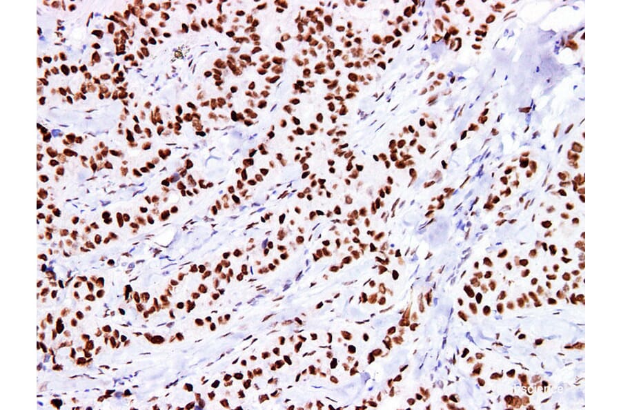 Validation Data - Anti-Estrogen Receptor a(ER) Antibody [YN00805m] (A288780)