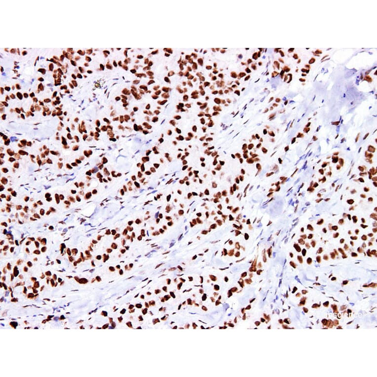 Validation Data - Anti-Estrogen Receptor a(ER) Antibody [YN00805m] (A288780)