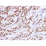 Validation Data - Anti-Estrogen Receptor a(ER) Antibody [YN00805m] (A288780)