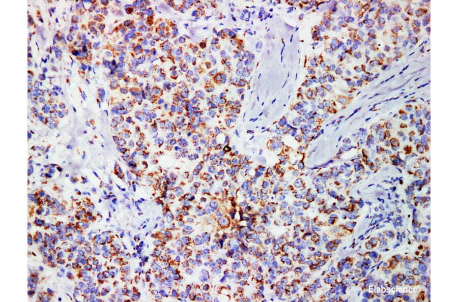 Validation Data - Anti-Mammaglobin Antibody [YN01026m] (A288782)