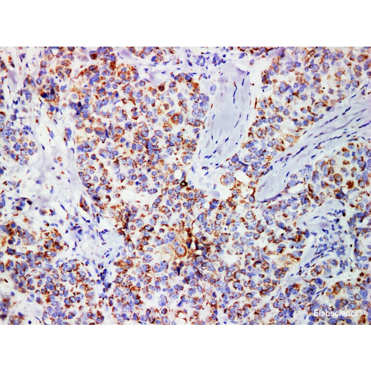 Validation Data - Anti-Mammaglobin Antibody [YN01026m] (A288782)