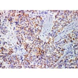 Validation Data - Anti-Mammaglobin Antibody [YN01026m] (A288782)
