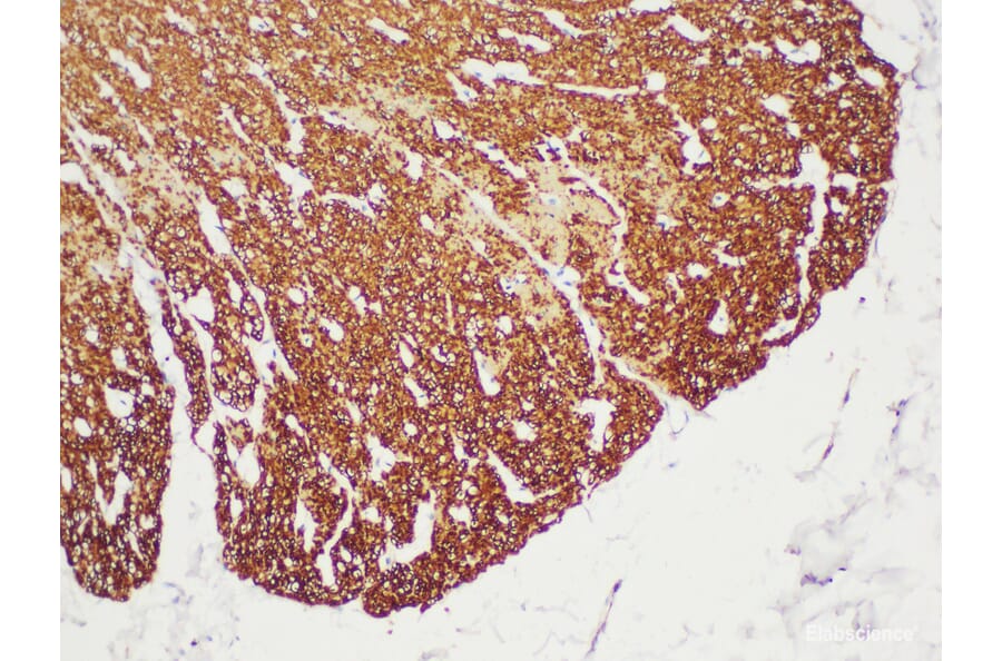 Validation Data - Anti-Actin smooth muscle(SMA) Antibody [YN00045m] (A288783)
