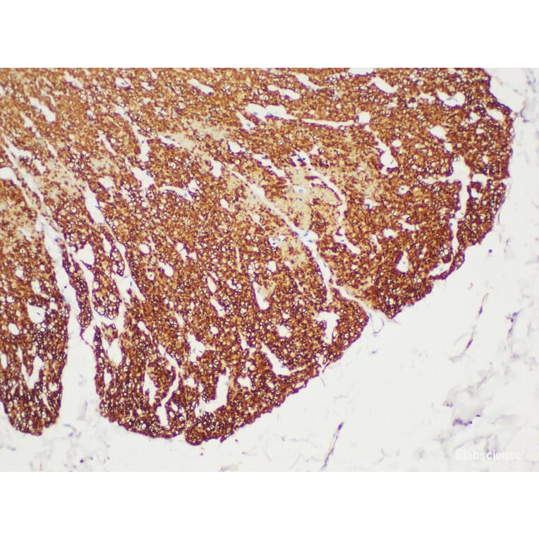 Validation Data - Anti-Actin smooth muscle(SMA) Antibody [YN00045m] (A288783)