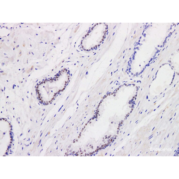 Validation Data - Anti-Androgen Receptor(AR) Antibody [YN00076m] (A288784)