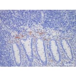 Validation Data - Anti-Calretinin(CR) Antibody [YN00166m] (A288785)