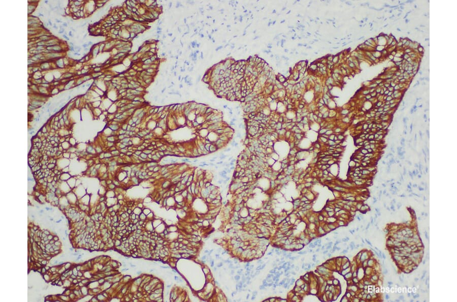 Validation Data - Anti-Cytokeratin 19 Antibody [YN00705m] (A288786)