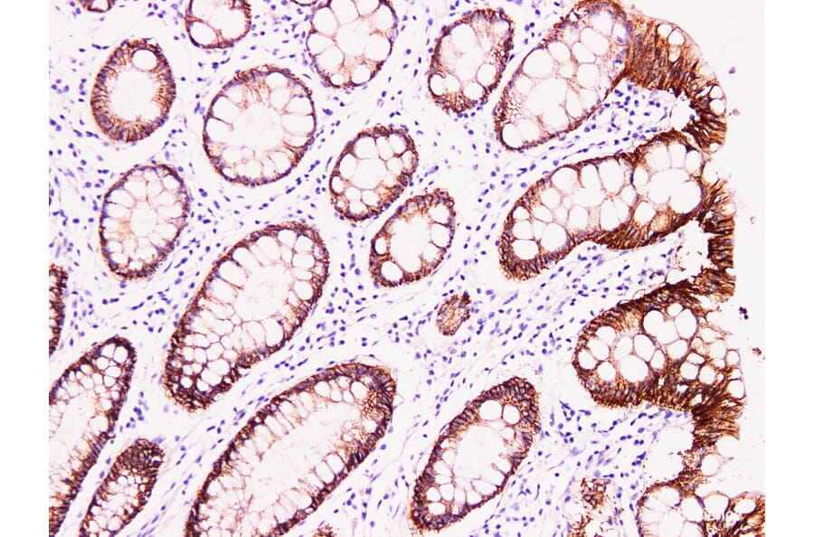 Validation Data - Anti-Claudin 4 Antibody [YN00506m] (A288787)