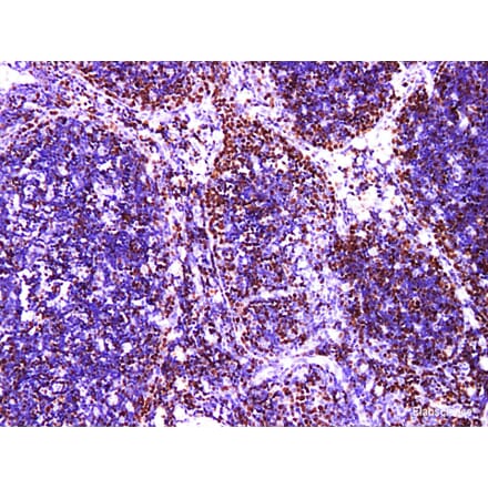 Validation Data - Anti-MCM2 Antibody [YN01046m] (A288789)