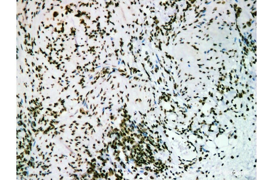 Validation Data - Anti-Nucleophosmin(NPM) Antibody [YN01206m] (A288790)