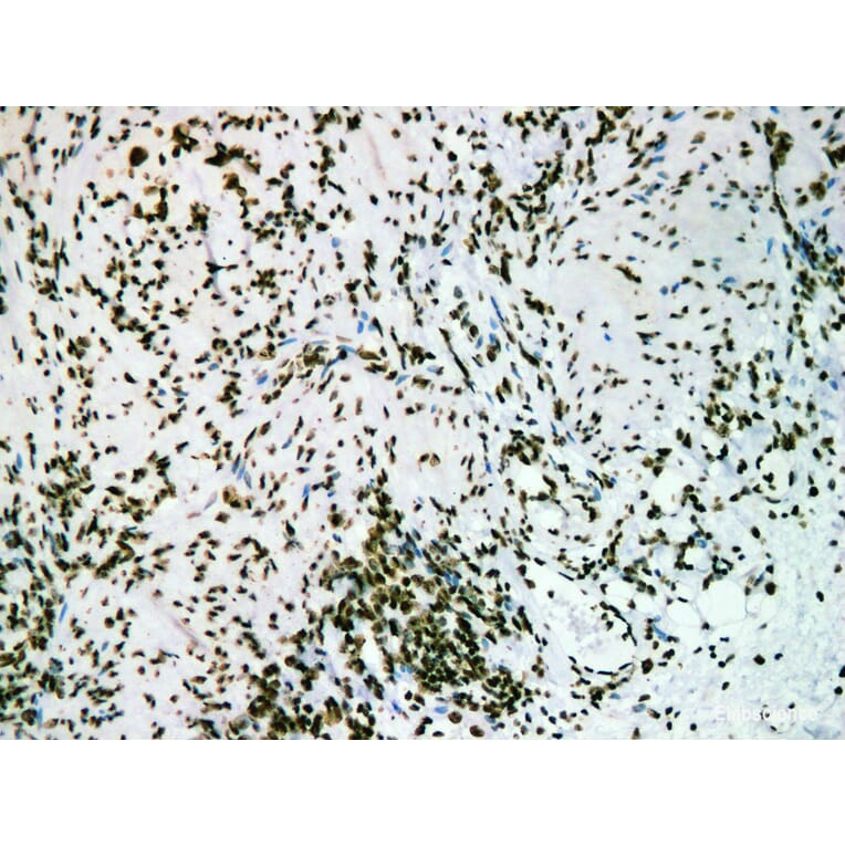 Validation Data - Anti-Nucleophosmin(NPM) Antibody [YN01206m] (A288790)
