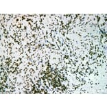 Validation Data - Anti-Nucleophosmin(NPM) Antibody [YN01206m] (A288790)