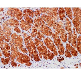 Validation Data - Anti-S100A1 Antibody [YN01466m] (A288791)