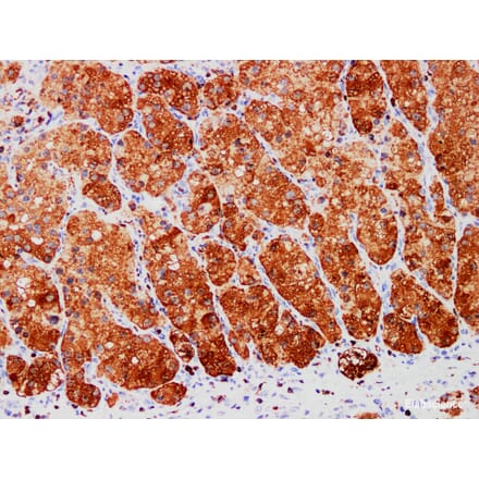 Validation Data - Anti-S100A1 Antibody [YN01466m] (A288791)