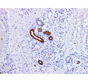 Validation Data - Anti-S100P Antibody [YN01495m] (A288792)