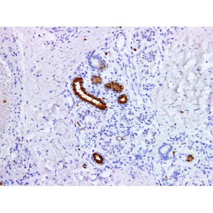 Validation Data - Anti-S100P Antibody [YN01495m] (A288792)